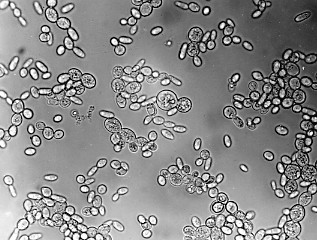 Mmm, brewer's yeast. (Photo courtesy of Kimball's Biology Pages)